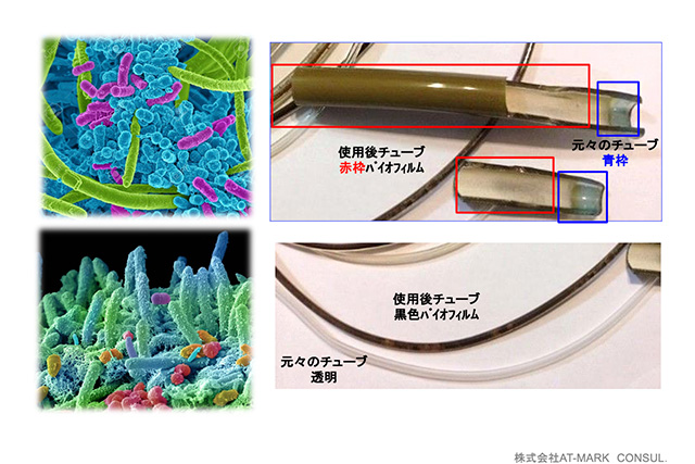 細菌感染